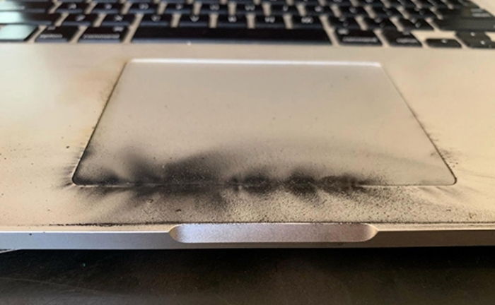 Máy tính phát nổ, bé trai bỏng nặng