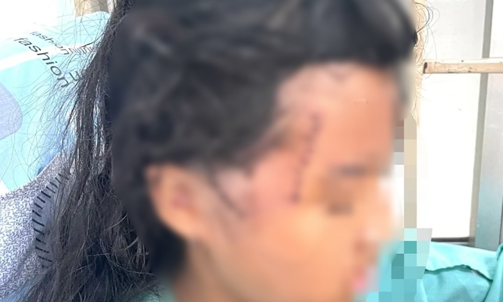 Đồng Nai: Tạm giữ gã 'chồng hờ' chém mẹ con người tình bị thương