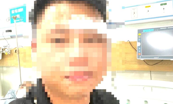 Bị nhóm người lạ hành hung, một luật sư ở Đà Nẵng phải nhập viện cấp cứu