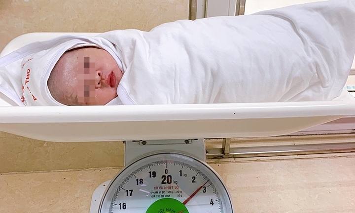 Em bé chào đời với dây rốn quấn cổ 5 vòng hiếm gặp