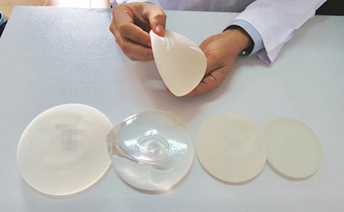 Đặt túi ngực được tư vấn ‘bảo hành vĩnh viễn’, 14 năm sau vỡ không triệu chứng