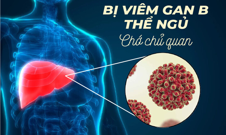 Cách chăm sóc gan, phòng tránh viêm gan B bùng phát