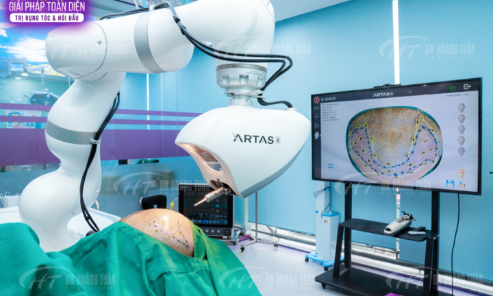 Cấy tóc tự động hoàn toàn bằng công nghệ ARTAS® IXi có những gì?
