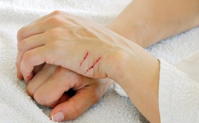 Tự ngược đãi bản thân vì áp lực 'con ngoan trò giỏi' 