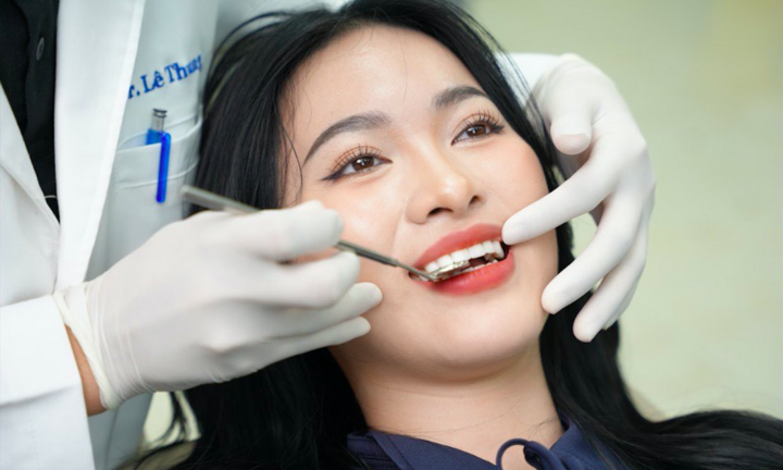Phòng khám Lavie Dental - Nha khoa bọc răng sứ thẩm mỹ tốt tại Hà Nội