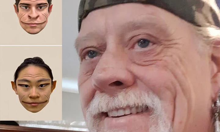 Người đàn ông mắc hội chứng 'nhìn người hóa quỷ'