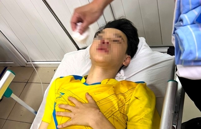 Trên đường đi thi lớp 10, nam sinh bị tai nạn phải bỏ thi