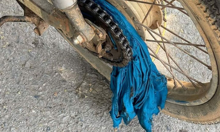 Áo chống nắng vướng bánh xe, người phụ nữ ngã gãy tay 