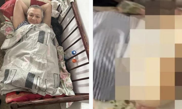 Bị chuột 'ăn thịt' trong khi say rượu, người phụ nữ mất cả 2 chân 