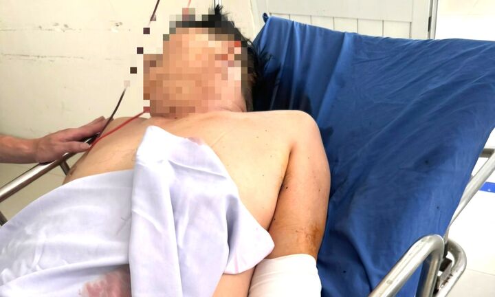 Điều tra vụ tài xế bị chém trọng thương ở Đà Nẵng