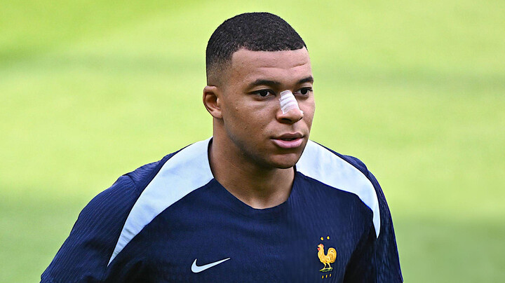 Lý do Mbappe bị gãy mũi nhưng chưa đeo mặt nạ