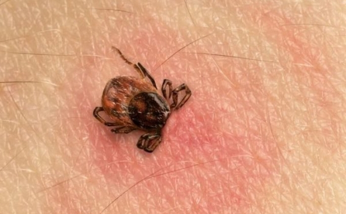 Suy đa tạng do bị mò đốt