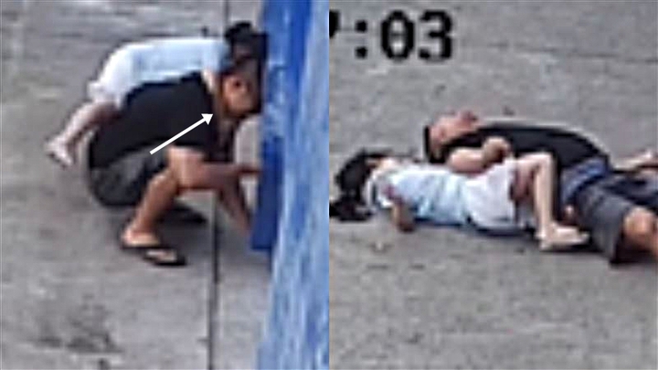 Bố ngất lịm, suýt chết khi bị con gái ôm cổ, chuyên gia khuyến cáo phải cẩn thận