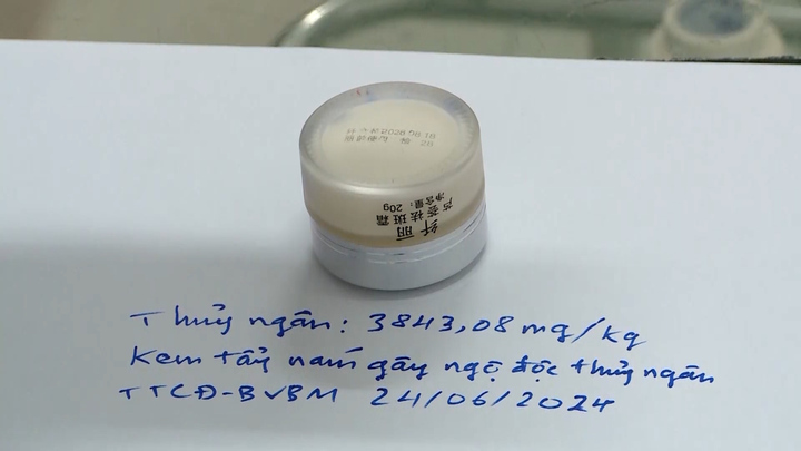 Dùng kem trị nám giá rẻ trên mạng, nữ bệnh nhân hôn mê sâu