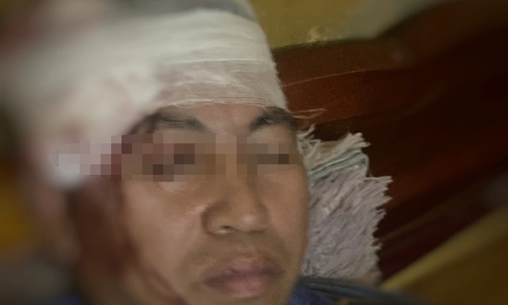 Phụ lái bị ném đá vỡ đầu khi tàu hỏa chạy qua Yên Bái 