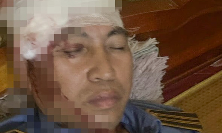 Triệu tập 8 thanh thiếu niên ném đá trúng đầu phụ lái tàu tuyến Hà Nội - Lào Cai