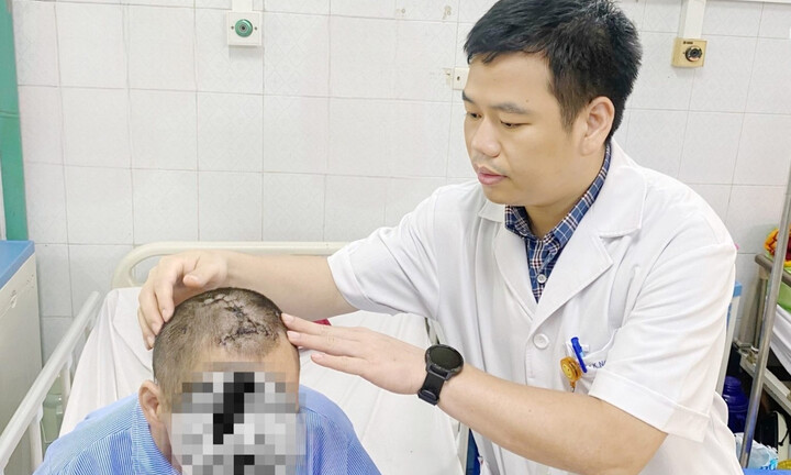 Người đàn ông trầm cảm tự đóng đinh sắt vào đầu