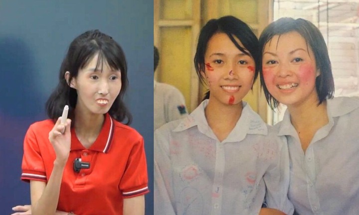 Cô giáo mầm non Hà Nội mắc bệnh lạ từ 'thiên nga' hóa 'vịt xấu xí'