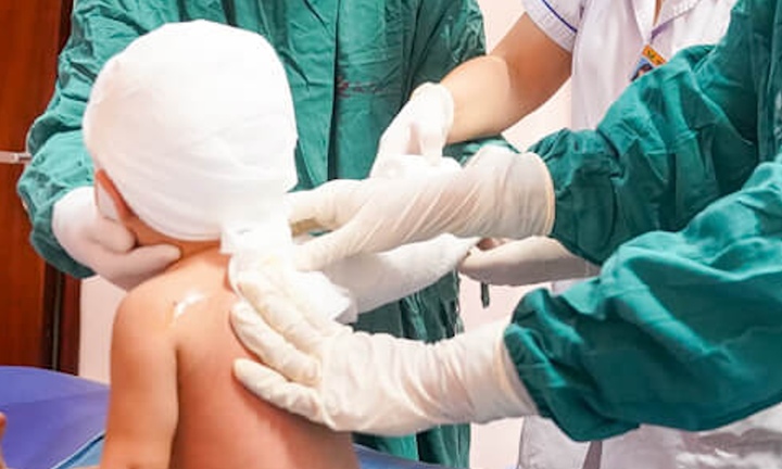 Bé ngã vào bát canh nóng, bôi mỡ trăn khiến bỏng càng nặng: Bác sĩ cảnh báo