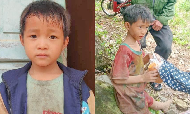 Bé trai lạc trong rừng 5 ngày sụt 4kg, bố mẹ thoạt nhìn không nhận ra con