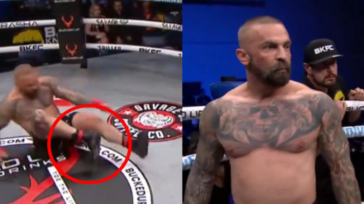 Ngã gãy cổ chân, võ sĩ 47 tuổi vẫn đòi đánh tiếp