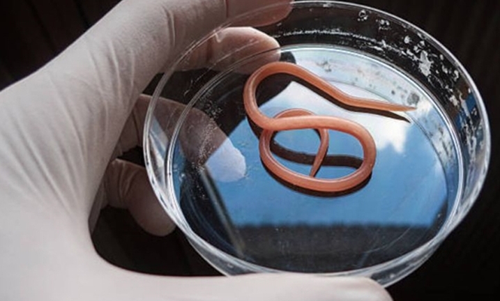 Giun đũa lúc nhúc trong đại tràng người đàn ông