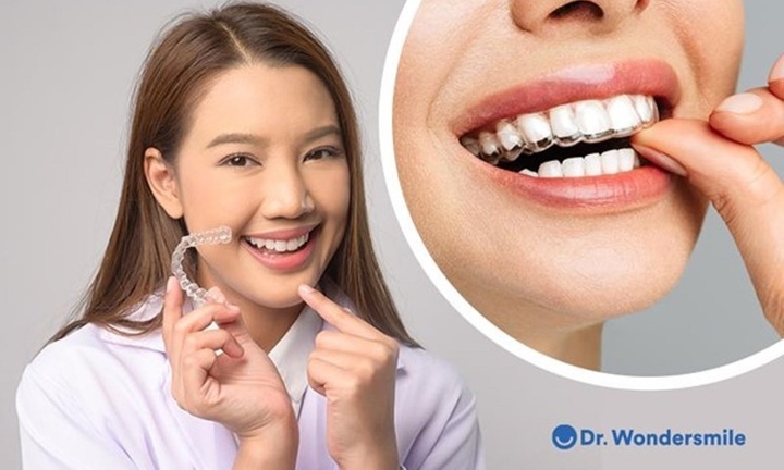 Khay niềng trong suốt ban đêm - sự lựa chọn thông minh cho người bận rộn