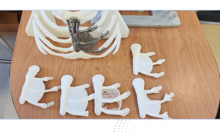 Đau ngực lâu không khỏi, đi khám phát hiện khối u lồng ngực