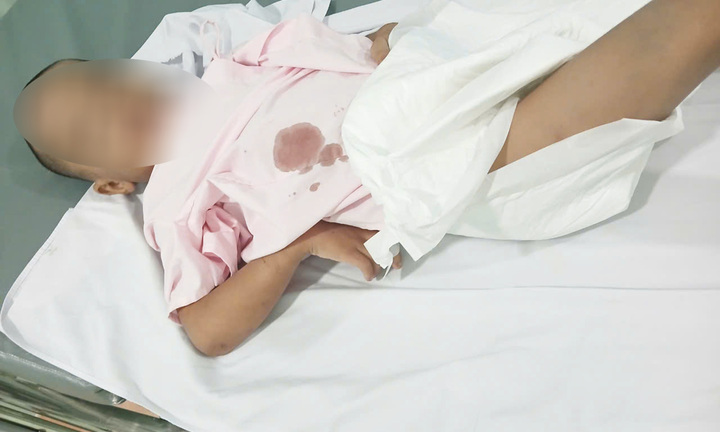 Bé 6 tuổi ở TP.HCM nghi bị bạo hành đến tổn thương gan, nhiễm trùng vết bỏng