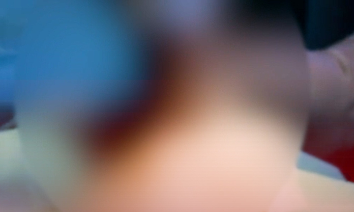 Cắt bao quy đầu ảnh hưởng đến sức khỏe sinh sản nam giới? 