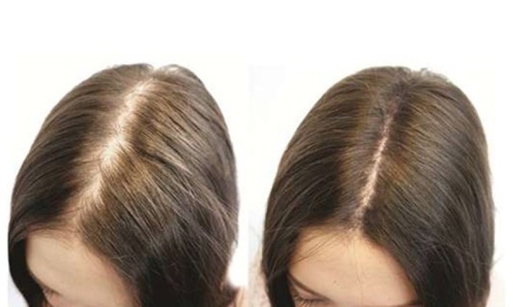 Mẹo kích thích tóc mọc nhanh