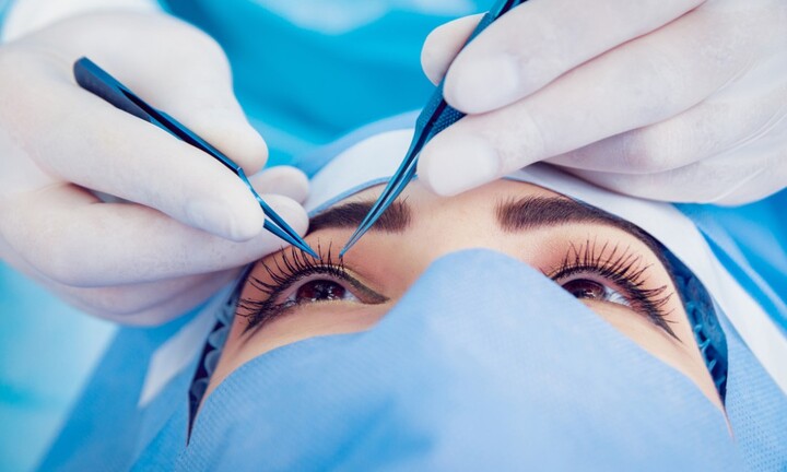 Bao nhiêu tuổi có thể mổ cận thị?