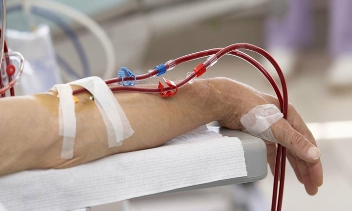 Lọc máu có phòng ngừa được đột quỵ?