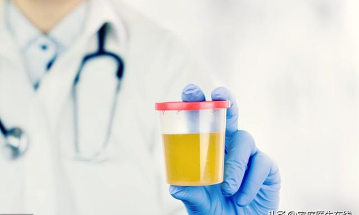 3 dấu hiệu bất thường của nước tiểu, cần cảnh giác nếu không muốn mắc bệnh