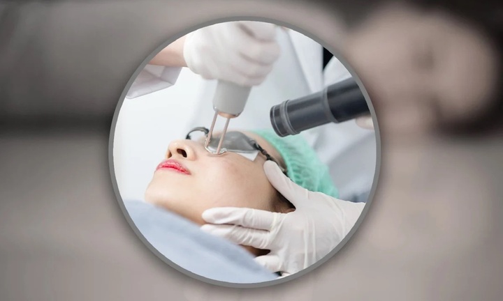 Cô gái chết sau 10 ngày xóa vết bớt bằng laser