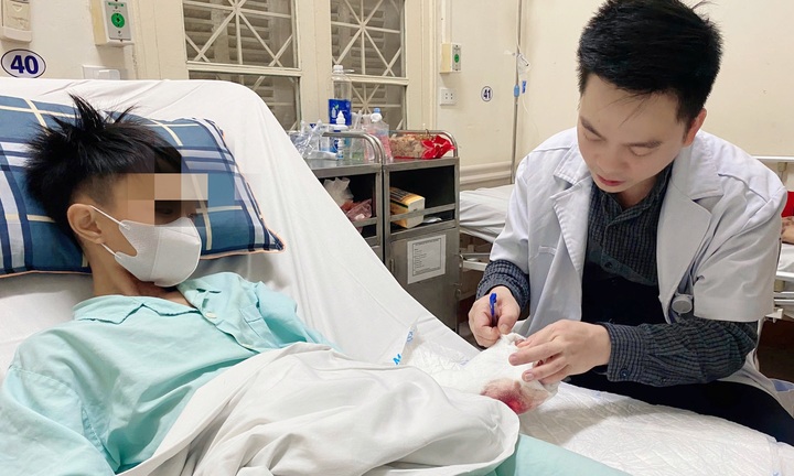 Chơi pháo tự chế, hai anh em dập nát tay