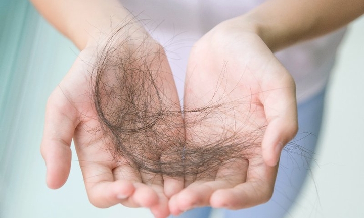 Sau hóa trị ung thư, bao lâu thì tóc mọc lại? 