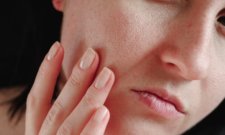 Mẹo chống khô da mùa đông