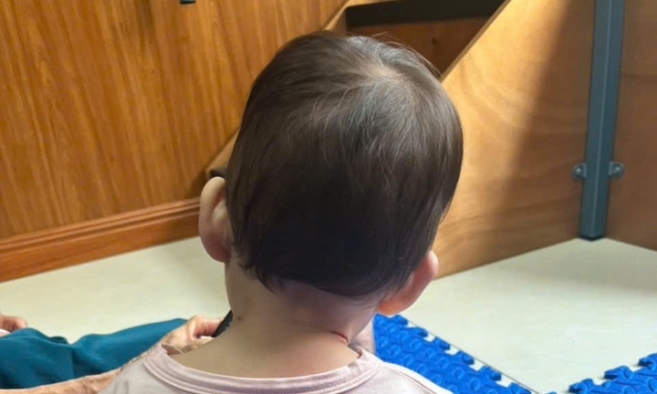 Sai lầm khiến trẻ bị vẹo cổ cha mẹ cần tránh