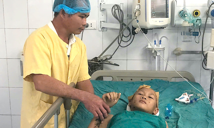 Mẹ nhổ cả sắn non bán, chắt chiu từng đồng cứu con trai bỏng thập tử nhất sinh