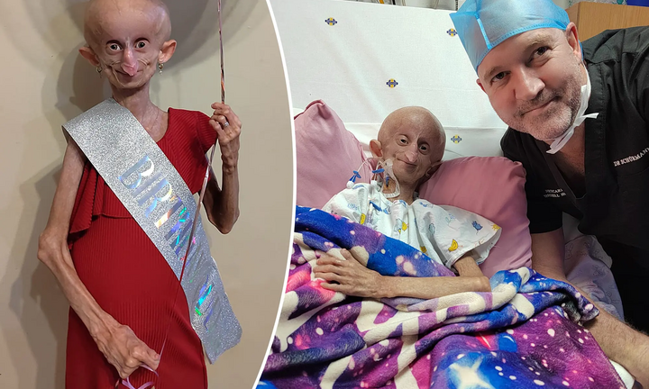 Hành trình chiến đấu bệnh lão hóa nhanh của nữ TikToker nổi tiếng Nam Phi