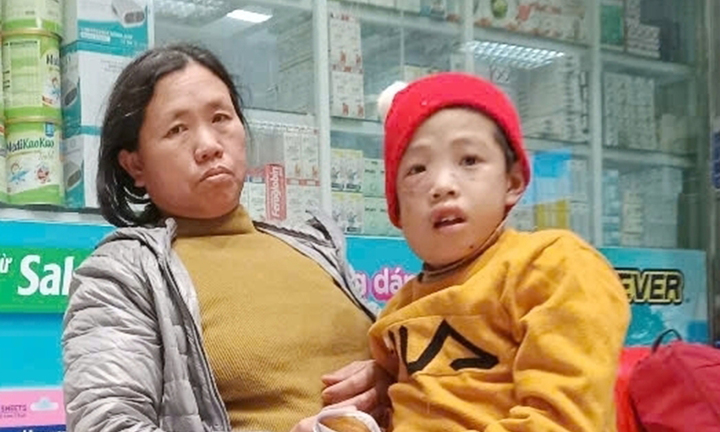 Khuôn mặt biến dạng vì bệnh hiếm, bé trai cần 2 tỷ đồng để ghép tuỷ