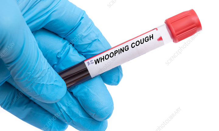 Bé gái 2 tháng tuổi ở Bình Phước tử vong do bệnh ho gà 