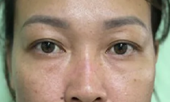 Nữ nhân viên gác chắn tàu bị đánh gãy mũi: Lời khai kẻ côn đồ