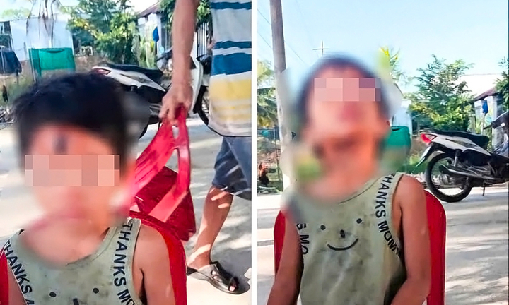 Điều tra vụ bé gái 6 tuổi nghi bị cha dượng bạo hành ở Kiên Giang