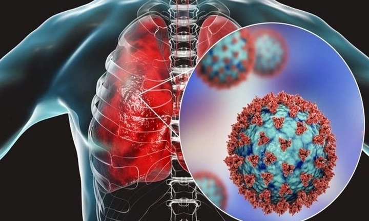 Virus viêm phổi HMPV lây lan ở Trung Quốc nguy hiểm ra sao?