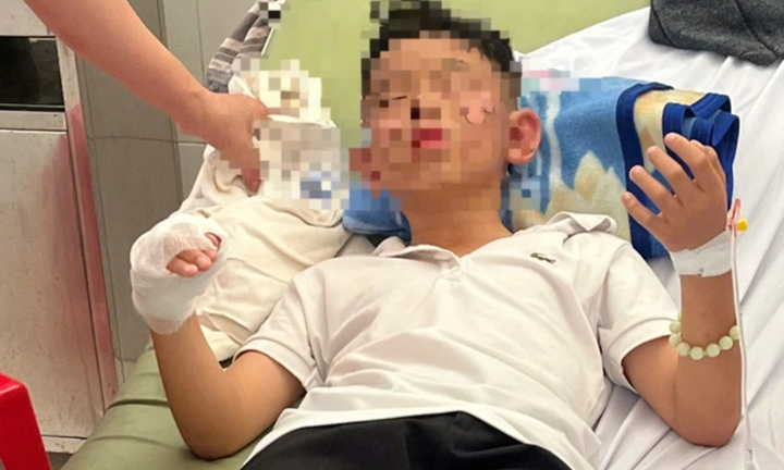 Bình gas phát nổ, 9 học sinh và giáo viên bị bỏng