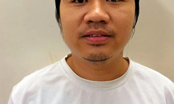 ‘Chuyên gia thẩm mỹ' Mr Lee Trương Thanh Tịnh bị bắt