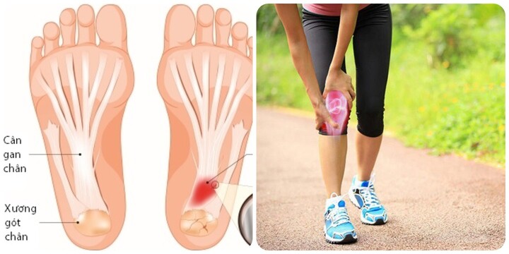 Tác hại của việc đi bộ quá nhiều