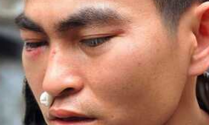 Diễn biến mới nhất vụ nam shipper bị tài xế Lexus đánh tới tấp